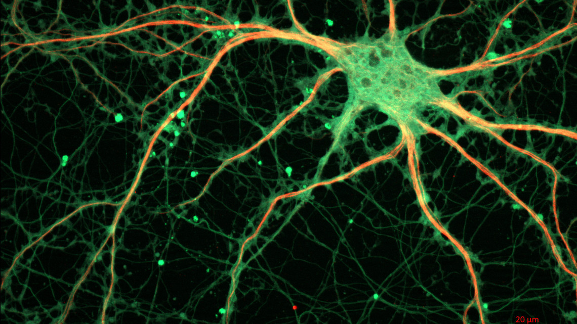 Cultured_Rat_Hippocampal_Neuron_(24327909026)