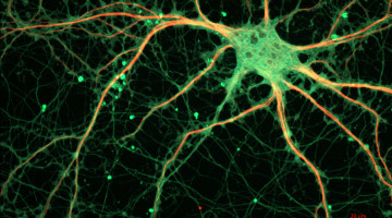 Cultured_Rat_Hippocampal_Neuron_(24327909026)