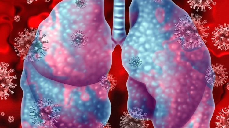 polmonite-virale-orig